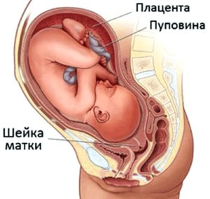 Как эрозия шейки матки влияет на беременность?