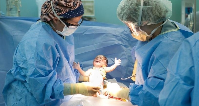 Кому не обойтись без кесарева сечения: плановая и внеплановая операция Кому не обойтись без кесарева сечения: плановая и внеплановая операция