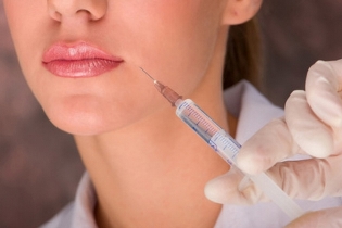 Выравнивание носогубных складок филлерами: как выбрать материал, и есть ли противопоказания? Выравнивание носогубных складок филлерами: как выбрать материал, и есть ли противопоказания?