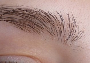 Почему появляется перхоть на бровях и как от нее избавиться? Почему появляется перхоть на бровях и как от нее избавиться?