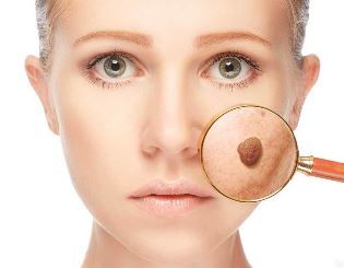 Что следует знать о выведении бородавок в домашних условиях? Что следует знать о выведении бородавок в домашних условиях?