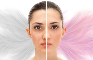 Сохраняем красоту при помощи процедуры фотоомоложения: как она проходит, и стоит ли ее опасаться? Сохраняем красоту при помощи процедуры фотоомоложения: как она проходит, и стоит ли ее опасаться?