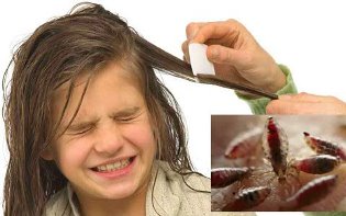 Причины педикулеза и способы быстро избавиться от вшей Причины педикулеза и способы быстро избавиться от вшей