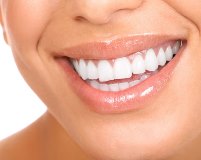 7 лучших способов быстро отбелить зубы в домашних условиях