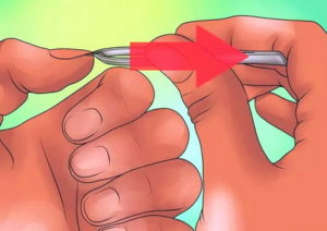 Как вытащить занозу из-под ногтя