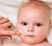 Сильно шелушится кожа у детей и новорожденных: причины и лечение