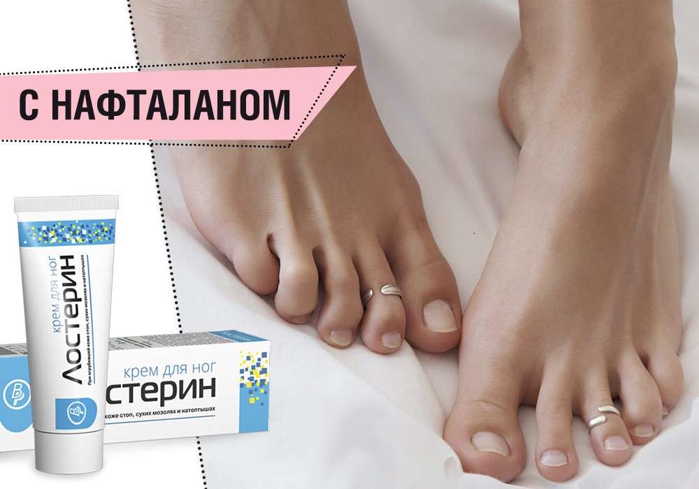 Невроз лица: симптомы и признаки, почему происходит онемение лицевых мышц, что такое парестезия лица, лечение