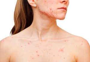 Выбор редакторов: 20 отличных кремов для борьбы с шелушениями