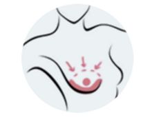 Почему появляются угри на лице — из за чего появляются угри — Заболевания