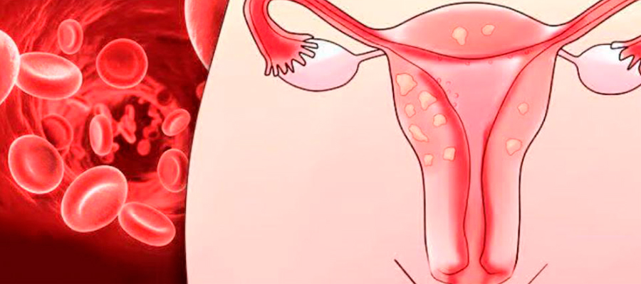 Гинекология — Болезненные менструации Гинекология — Болезненные менструации