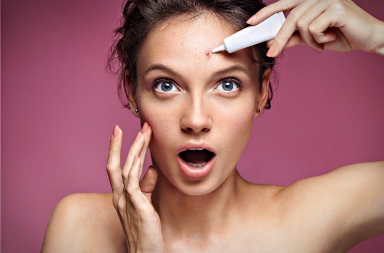 Угри на лице (4 разновидности) – лучшие методы борьбы