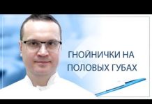 Прыщи на половых губах: почему появляются, какие анализы сдать, как лечить