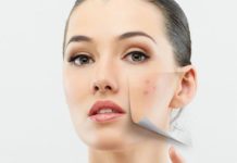 Об уплотнениях и шишках на лице под кожей: причины появления, способы избавления