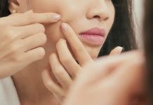 Почему появляются прыщи на лице у женщин после 30-35 лет и как с ними бороться