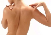 Прыщи на спине и плечах — почему возникают, как побороть