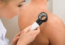 Как избавиться от прыщей на спине, плечах, груди, быстров домашних условиях