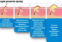 Гнойные прыщи на ногах у мужчин и женщин: почему появляются, как избавиться