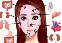 Прыщи на лице у женщин