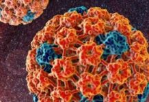 Вирус папилломы у женщин: 13 причин, 4 пути передачи, симптомы, лечение