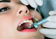 Лечение кариеса зубов Лечение кариеса зубов