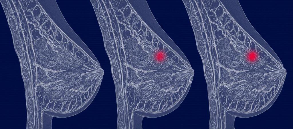 Вид диагностик рака молочной железы