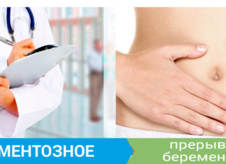 Медикаментозный аборт Медикаментозный аборт