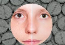 Маски от черных точек на основе активированного угля: свойства, простые рецепты, готовая косметика