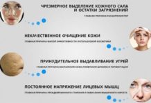 Проблемная кожа лица — как вылечить кремами, гелями, масками и лосьонами