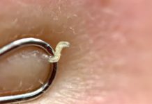 Палочка для удаления черных точек: как называется и как пользоваться? |