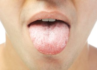 Красные точки на языке: причины и лечение