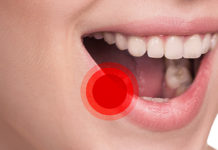 Черная точка на губе: причины появления и как убрать, отзывы