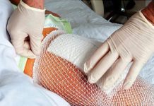 Почему после операции чешется шов и как устранить зуд