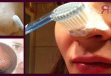 Как убрать черные точки на лице — чистка лица от черных точек