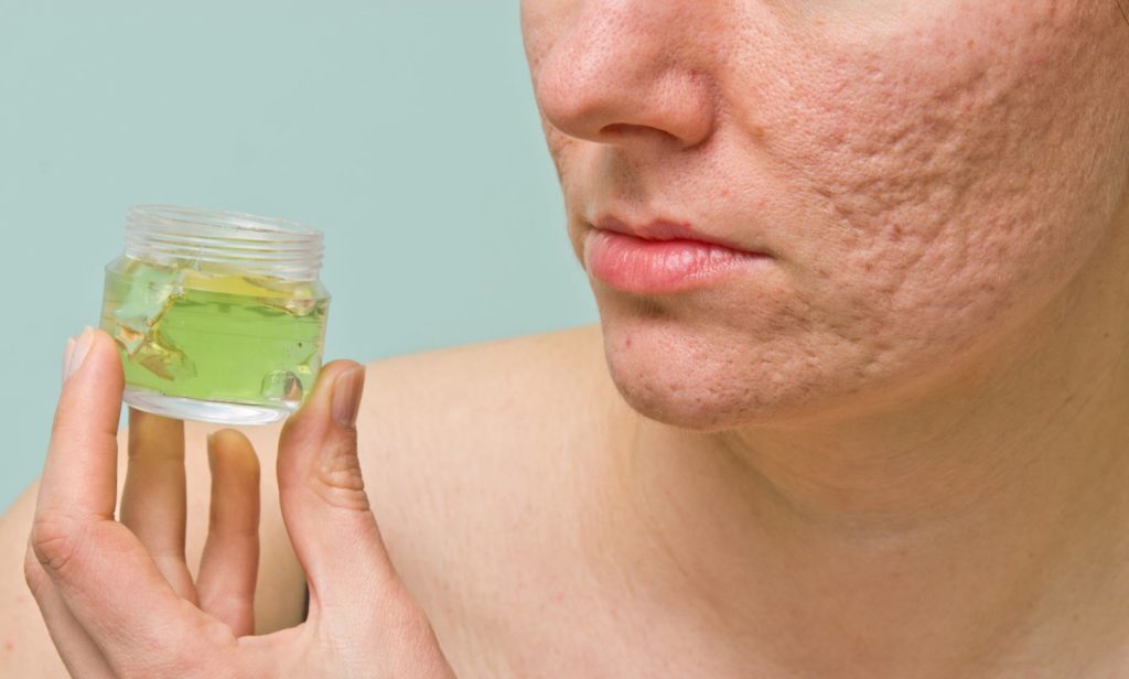 Лучшие масла для проблемной кожи, ТОП-20, польза масел для кожи лица
