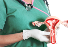 Эндометрит: причины возникновения, симптомы, диагностика и лечение