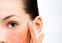 Уход за чувствительной кожей лица и проблемной, жирной. Средства по уходу