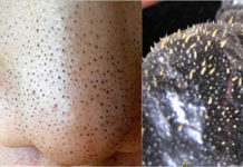 Лучшие ежедневные гели для умывания от прыщей для подростков: отзывы