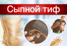 Сыпной тиф — Медицинская энциклопедия