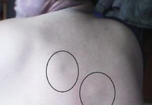 Образования под кожей: шишки, шарики, уплотнения, жировики