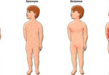 Какая сыпь при основных детских инфекционных болезнях?