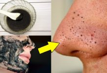 Как быстро убрать черные точки на лице в домашних условиях