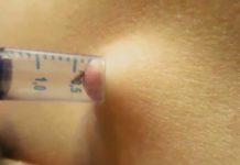 Можно ли жировик вытянуть шприцом