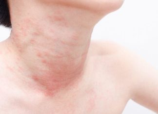 Кожные заболевания у детей (Фото): описание, лечение и профилактика