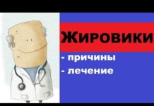 Липома: что это такое по МКБ 10: как выглядит и как лечить