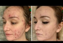 Vichy Dermablend (Виши Дермабленд): тональный крем для проблемной кожи Лифтактив Флюид, идеальный тон для жирной 3d Correction