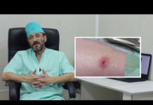 Рекомендации при фурункулезе: можно ли греть и мочить чирей