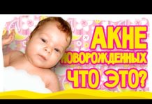 Акне новорожденных: фото цветения на лице, как отличить от аллергии | Комаровский