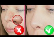 Чистка лица в домашних условиях от черных точек: быстрая и эффективная
