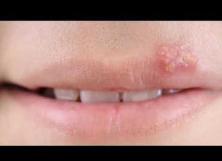 Сыпь при токсоплазмозе фото на коже: диета, методы терапии, первые признаки, последствия