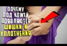 Вскочил шарик на попе в виде шишки